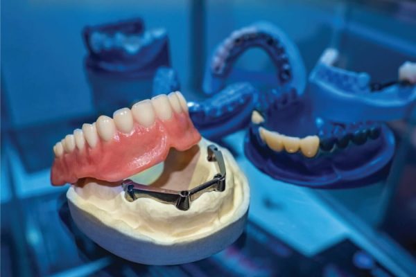 Dentures-&-Prosthetics