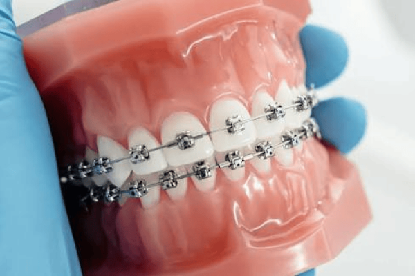 Orthodontic